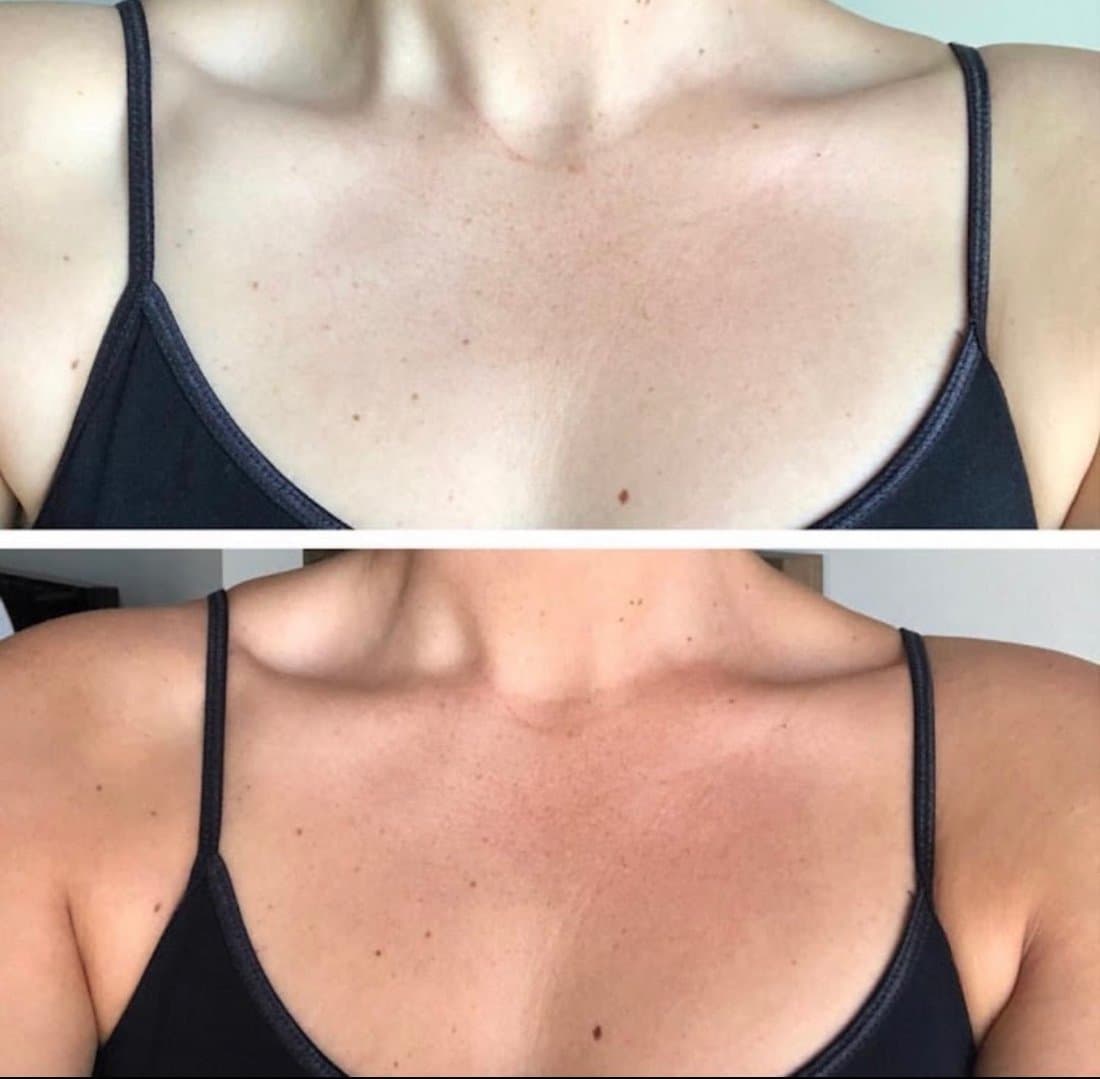 A real Spray Tanning by Rosie client — pale décolletage before, an even golden tan after
