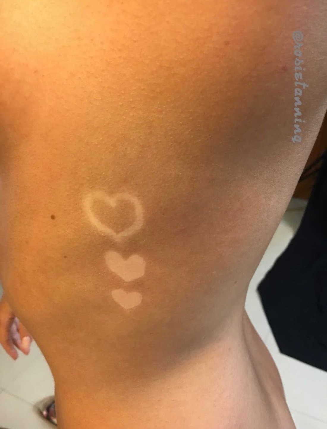 A real client's back with a playful heart design left in the spray tan